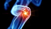 Anti-inflammatory effects Anti-inflammatory effects
